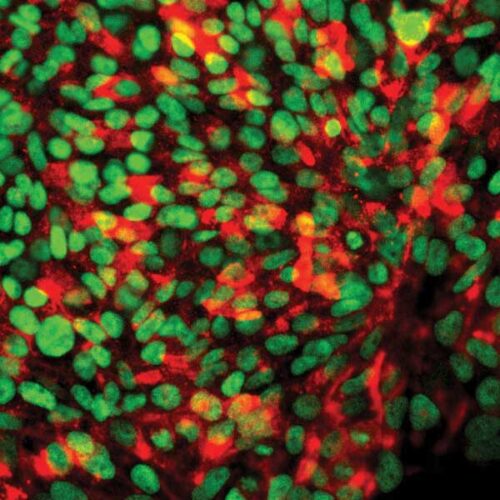 Cardiac Cell Quality in Microgravity