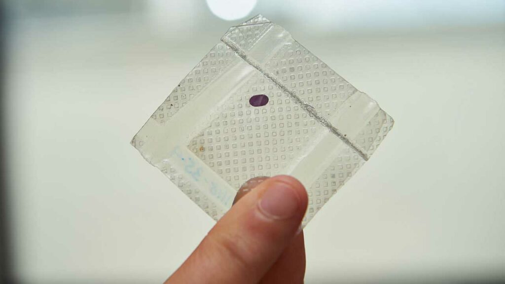 LambdaVision’s tiny protein-based retinal implant. 