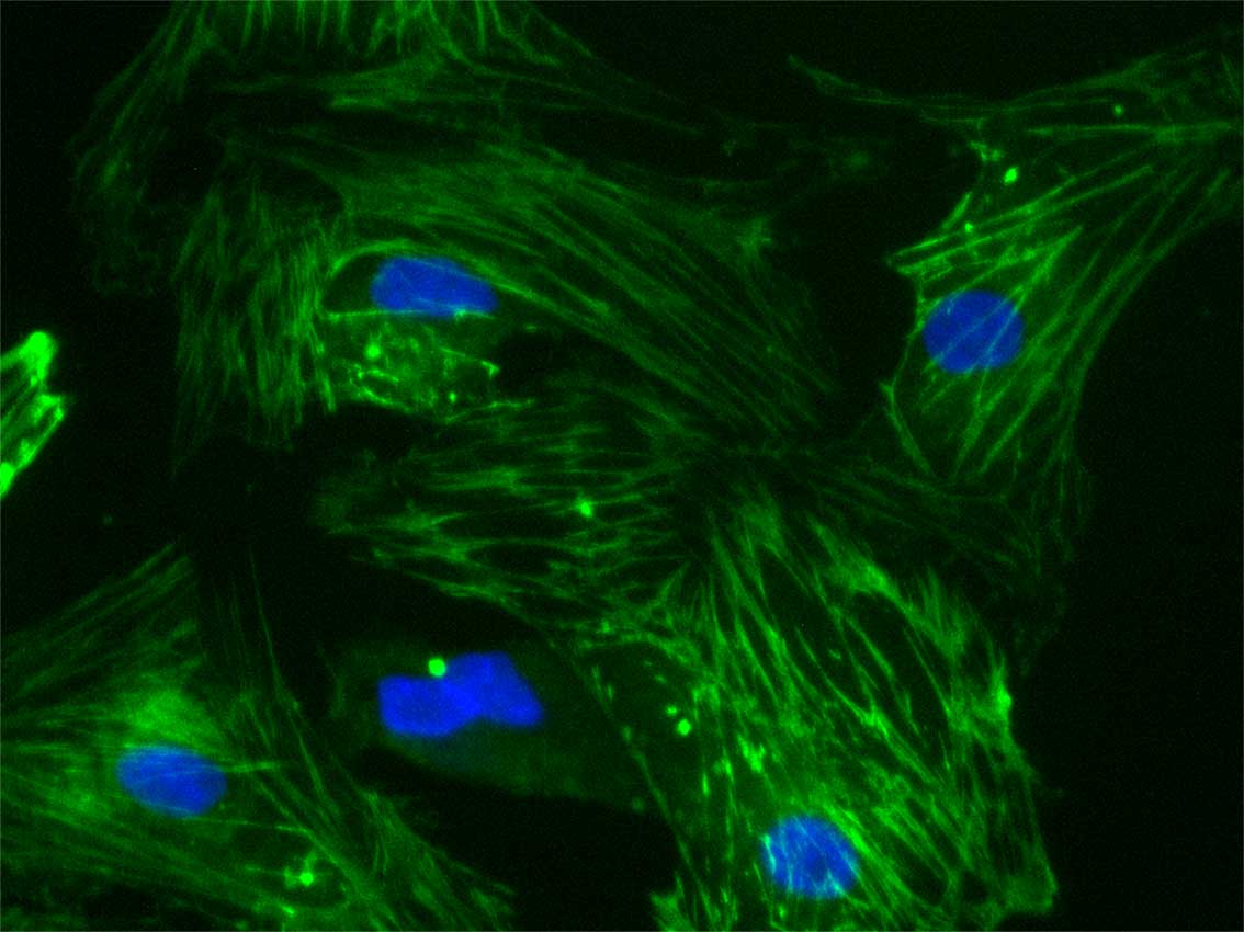 Heart muscle cells stained for muscle proteins (green) and nuclei (blue).