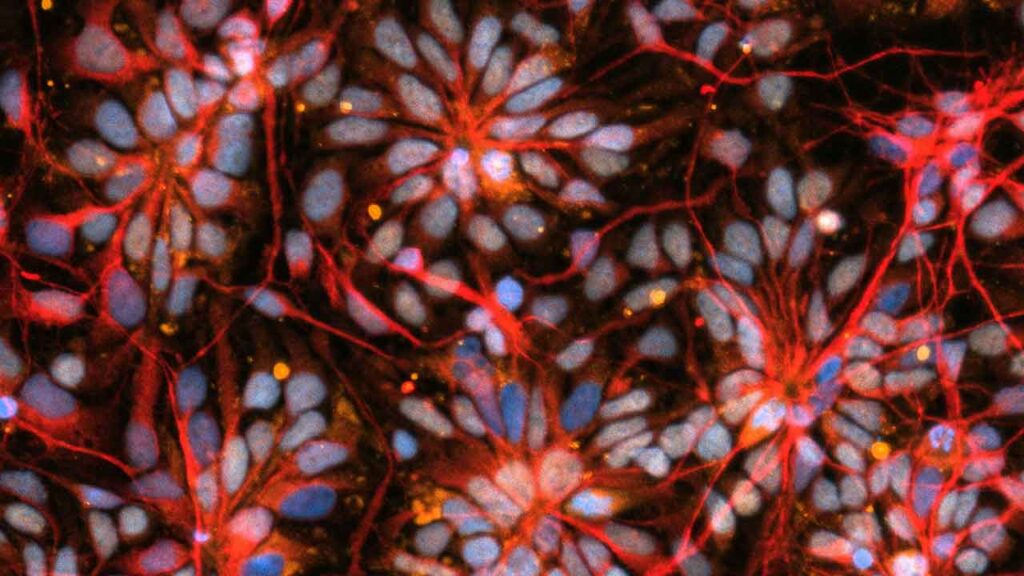 Early stage brain cells from NCSF study of primary progressive MS on SpaceX CRS-30 (March 21, 2024 - April 30, 2024).