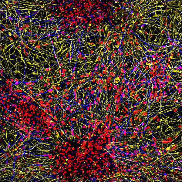 This image shows projections of neurons (yellow) and astrocytes (blue) from human brain organoids, with cell nuclei marked in red.