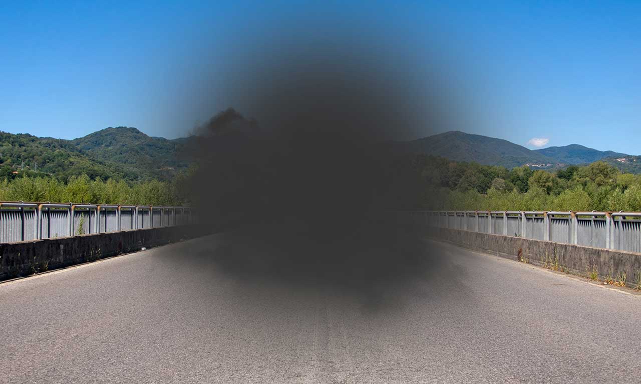Age-related macular degeneration results in the loss of central vision as simulated here