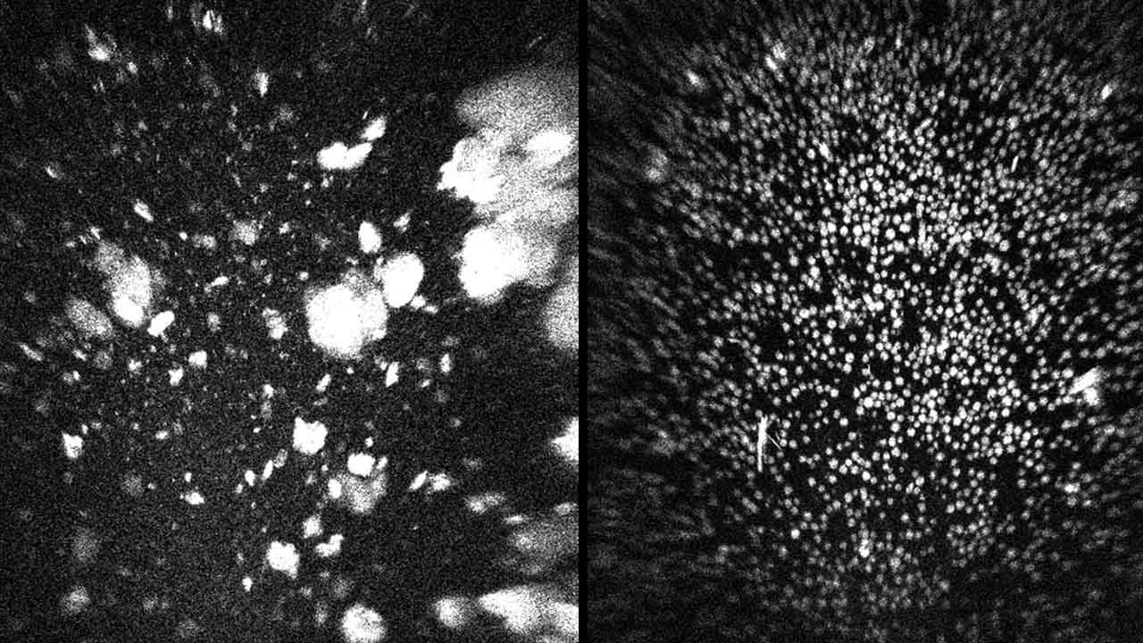 photo-essay-rd-merck Crystal growth research in space is helping Merck improve the way its Keytruda cancer therapy is given to patients.