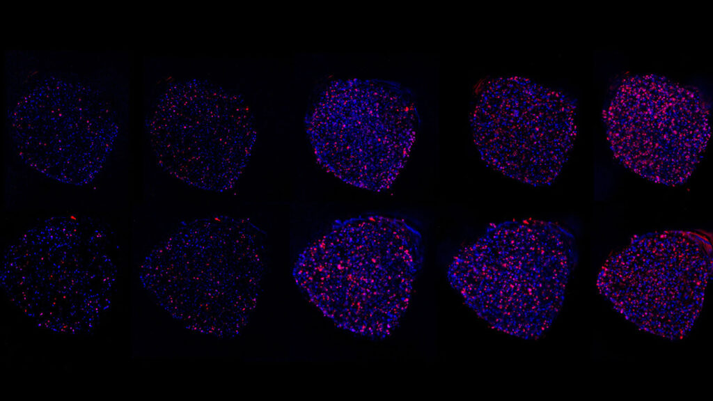 This microscopic image captures how microgravity allows tumor cells to self-assemble into clusters, mimicking their behavior in the human body.