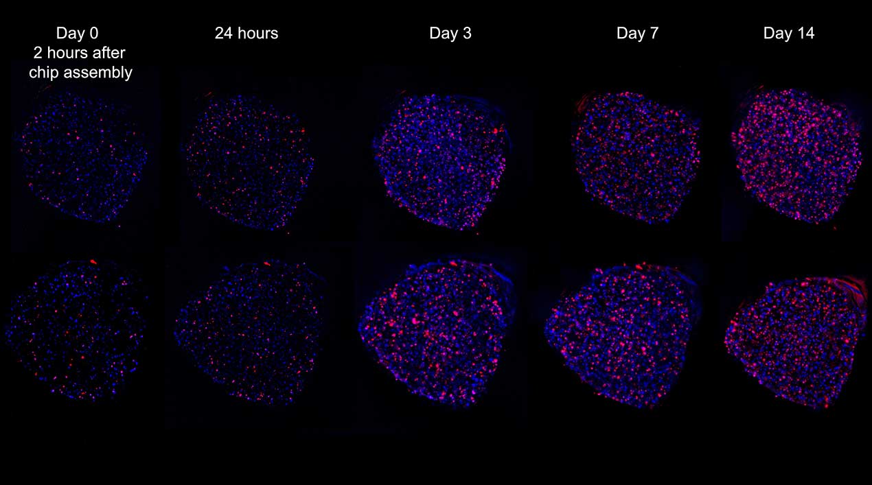 upward-82-encapsulate-onstation-cells This microscopic image captures how microgravity allows tumor cells to self-assemble into clusters, mimicking their behavior in the human body.