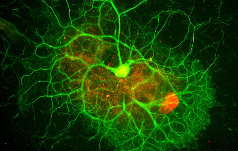 A brain organoid's human neurons branch into bright green networks.