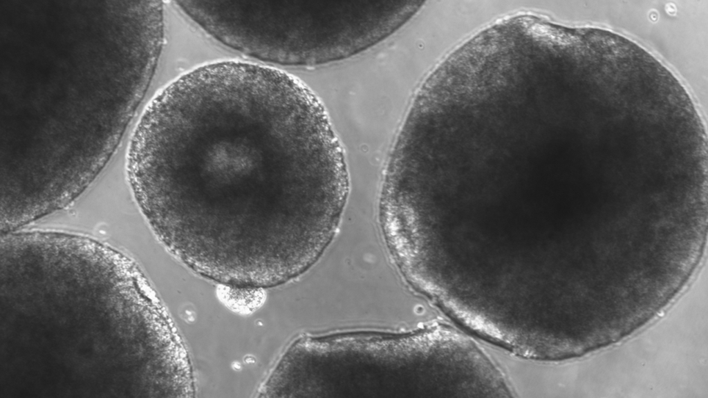 Human brain organoids grown in Alysson Muotri’s lab form three-dimensional clusters of neural cells, giving researchers a way to study brain development, disease, and the effects of spaceflight in a dish.