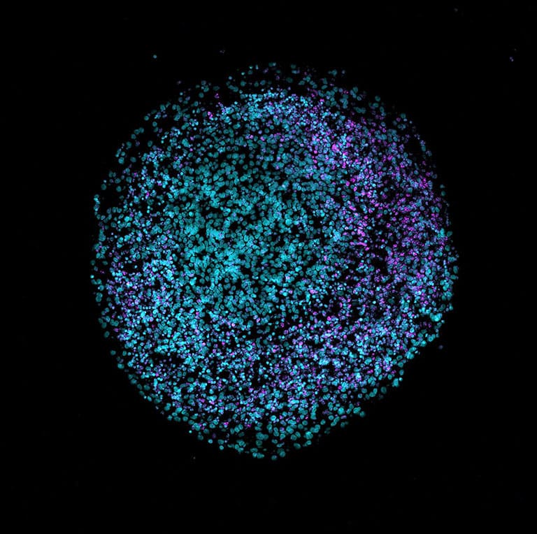 2D cryosection of a human brain organoid grown in a laboratory on Earth and stained with DAPI (teal) and VIPR2 (magenta).