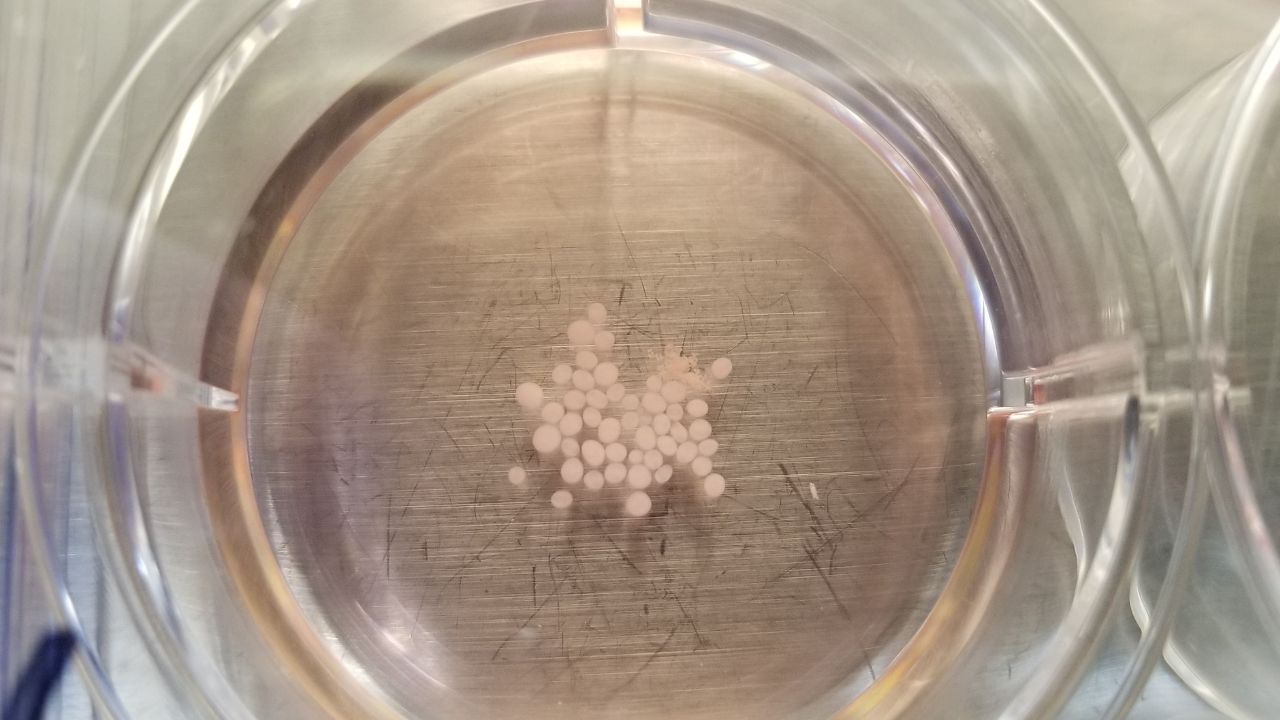 Brain organoids grown in Alysson Muotri’s lab cluster in a culture dish.