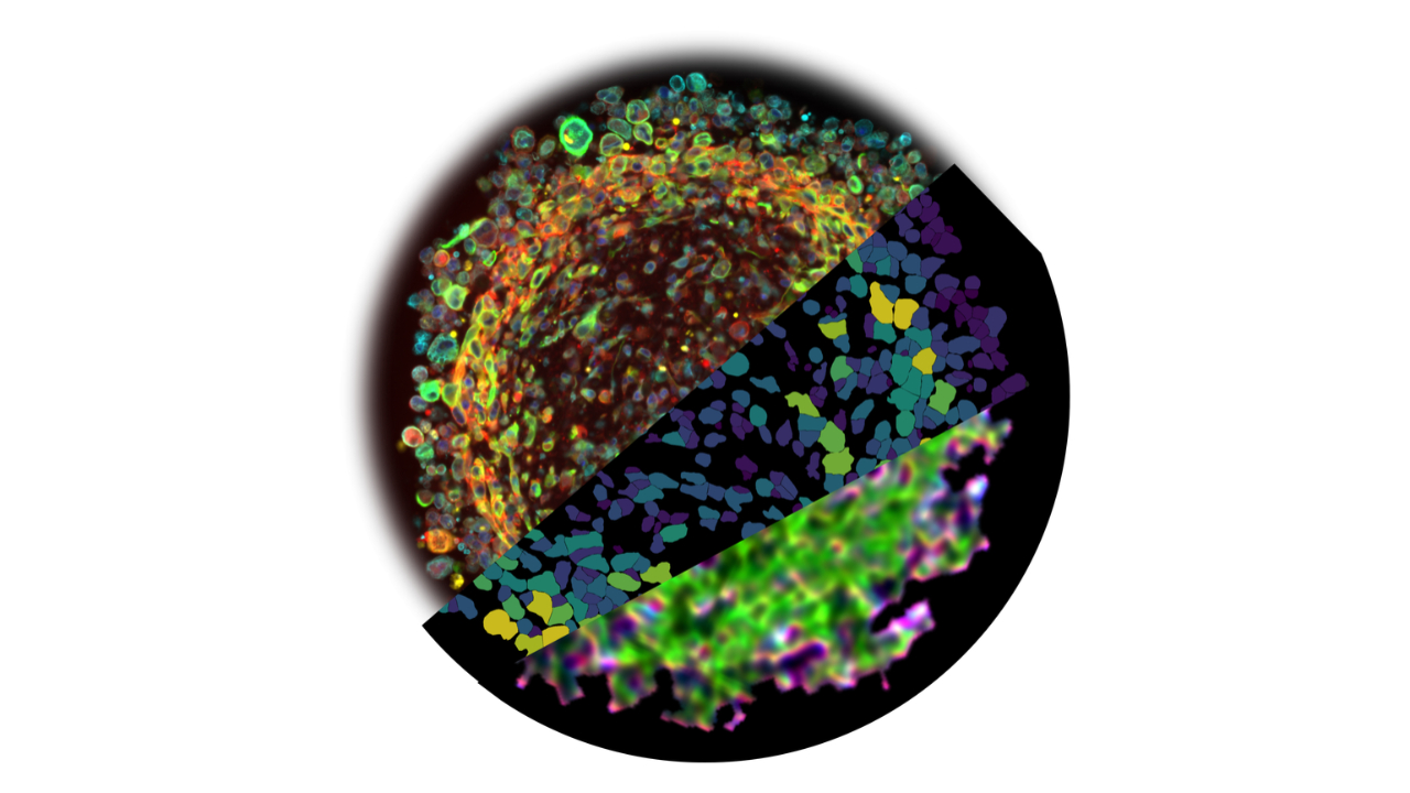Orthogonal spatial multi-omics on a long-term space-grown glioblastoma organoid analyzed for proteomics, transcriptomics, and chemical species imaging. (Left: representative multiplexed immunofluorescence; Middle: spatial transcriptomics, representative gene expression levels; Right: spatial FTIR chemical imaging)